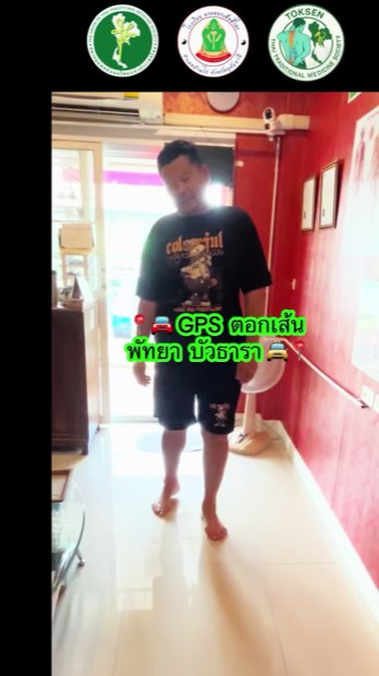 ตอกเส้นแก้ออฟฟิศซินโดรม กระดูกทับเส้นประสาท
